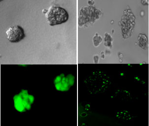 PLOS ONE:細菌的&ldquo;通訊系統&rdquo;可用于阻止或殺死癌細胞